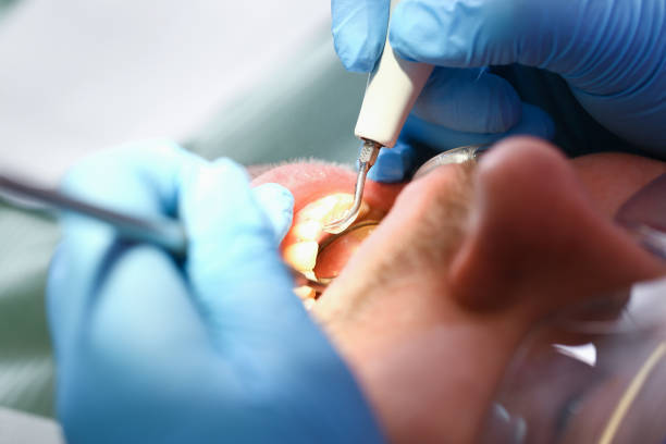 Best Knocked-Out Tooth Emergency  in Conley, GA
