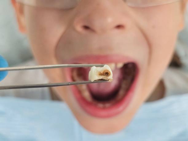 Best Dentist for Dental Trauma  in Conley, GA